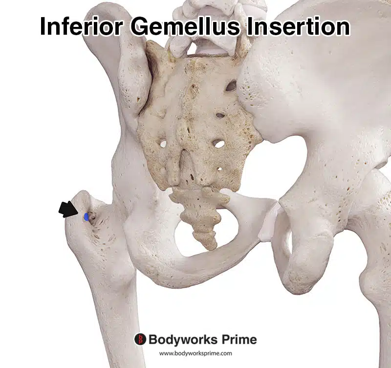 Inferior gemellus insertion marked in blue