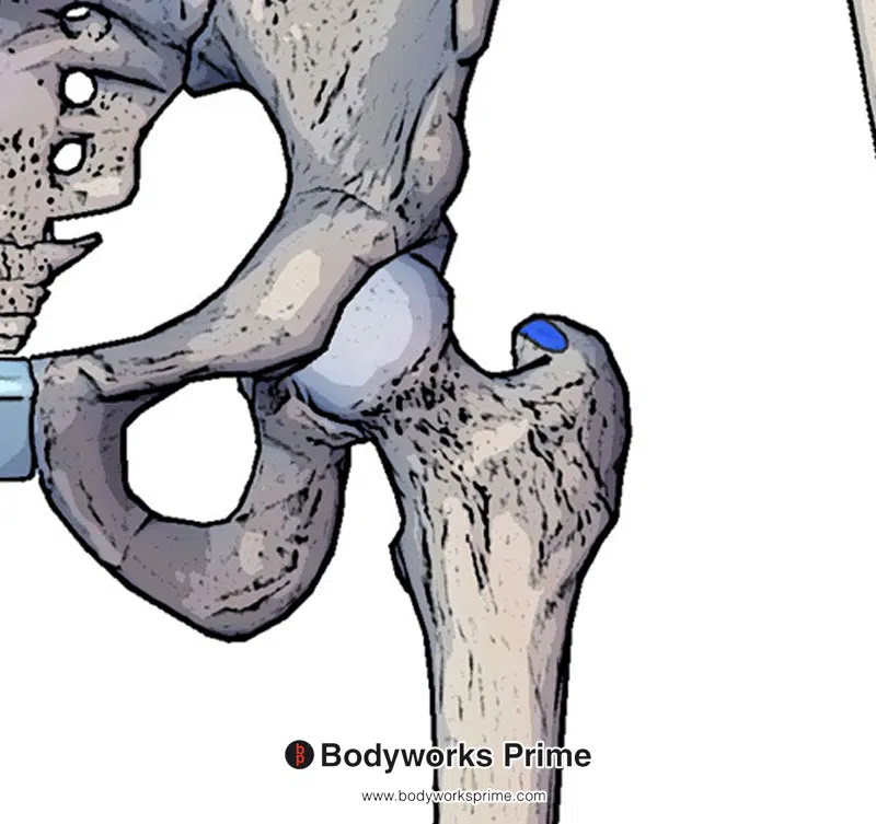 An image of the piriformis insertion marked in red on the greater trochanter of the femur