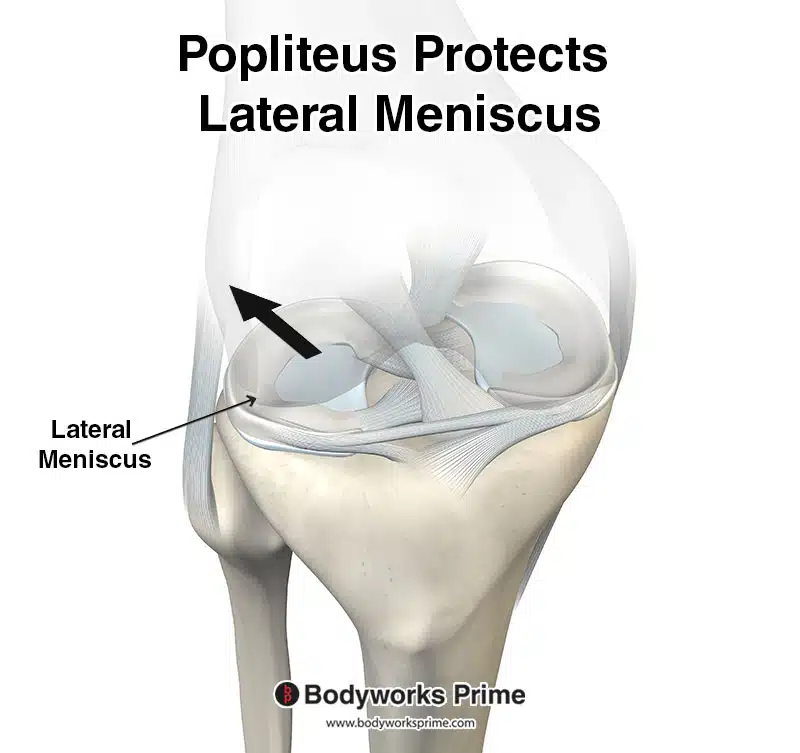 Image indicating posterior movement of the lateral meniscus of the knee